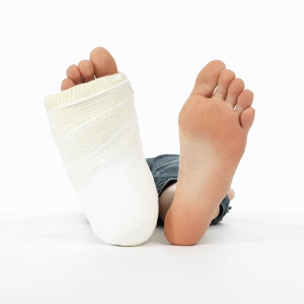 ورق تغليف ذكى يشفى العظام المكسورة فى نصف الوقت