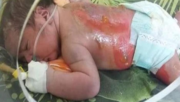 احتراق طفل رضيع داخل حضانة خاصة بالإسكندرية