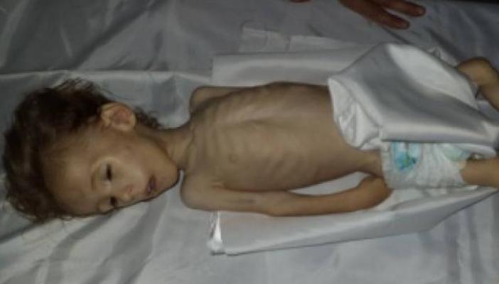 “أطباء بلا حدود”: مصرع 16 شخصًا في مضايا السورية جراء الجوع