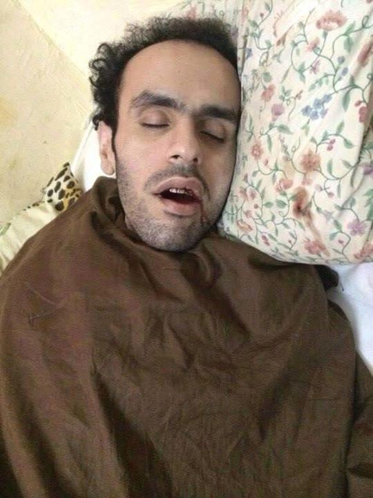 سلطان يدخل يومه الـ380 في الإضراب عن الطعام