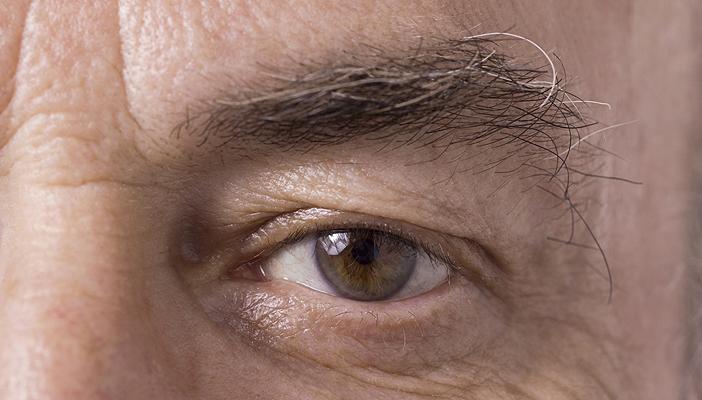 مليون مصري في طريقهم للإصابة بالعمى بسبب المياه الزرقاء