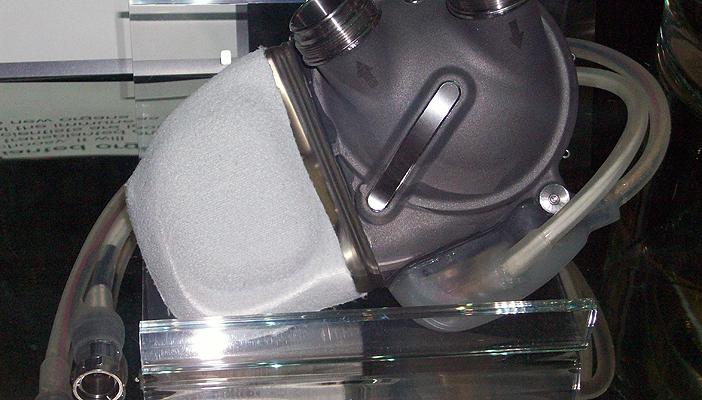 نجاح ثاني عملية تركيب قلب صناعي لمريض بفرنسا