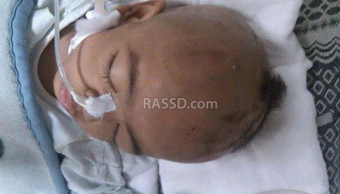 والد طفلة مستشفى الهرم لـ”رصد”: قتلوا ابنتي بـ 6 محاقن مجهولة المصدر