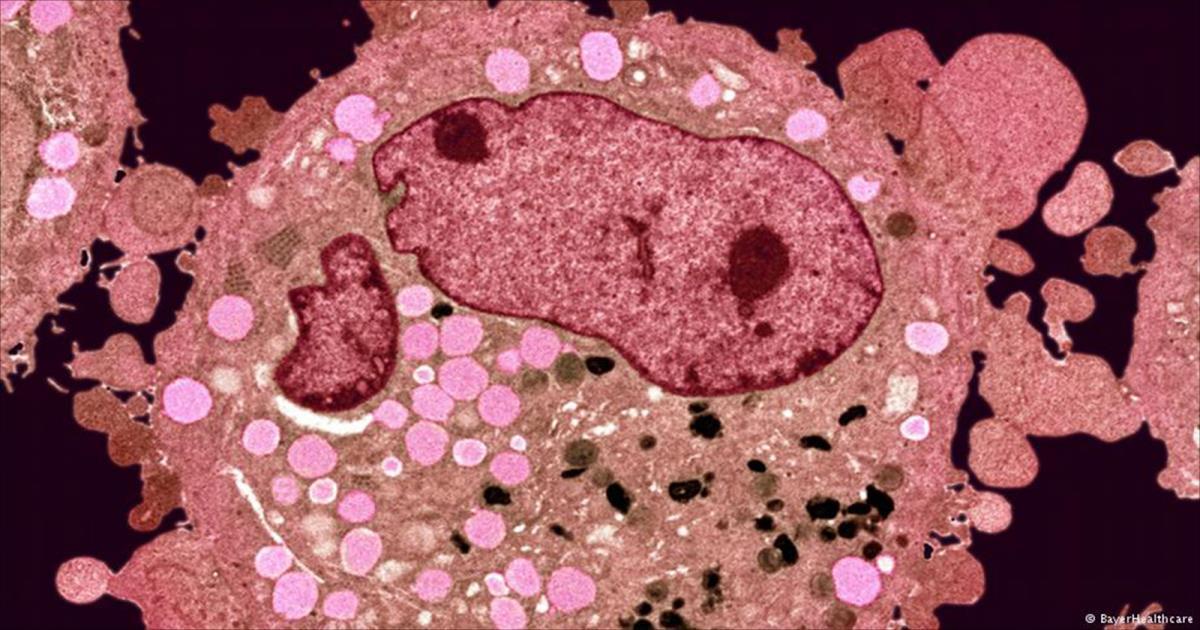 علماء أميركيون يتوصلون إلى علاج جديد لأخطر أنواع سرطان الجلد