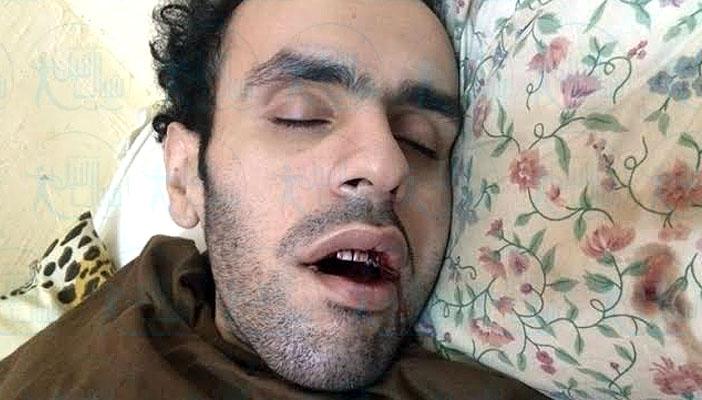 سلطان يواصل إضرابه لليوم الـ 473 على التوالي