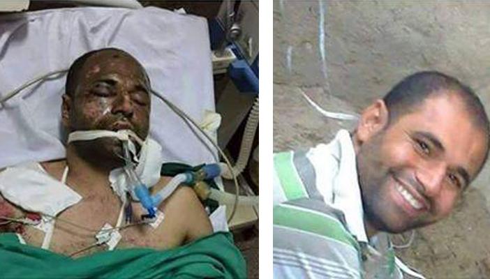 #نصر_بيموت هاشتاج للمطالبة بالإفراج عن معتقل مصاب في الإسكندرية