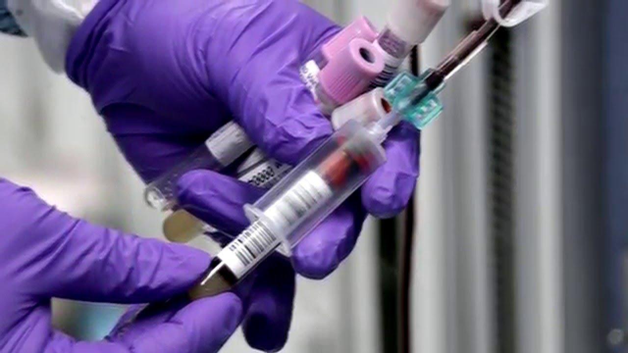 كميته لدى الرجال أعلى من النساء.. 4 حقائق غير معروفة عن الدم