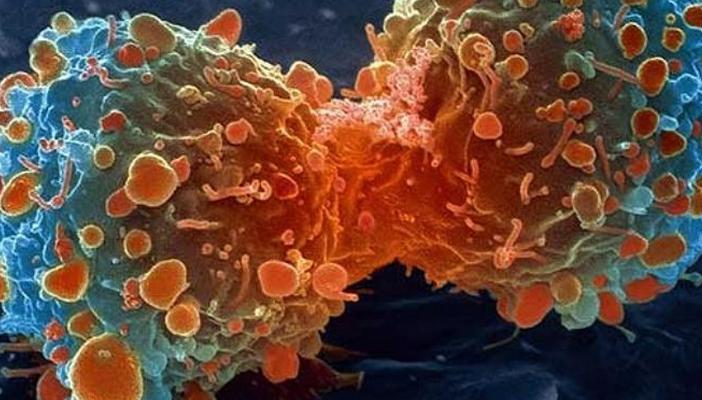 بالصور.. تعرف على أعراض السرطان الخفية