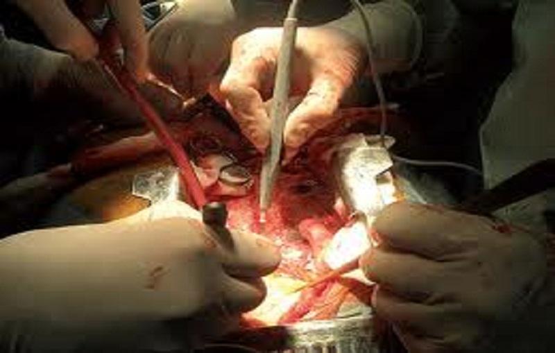 تقنية جديدة تحافظ على حياة الأعضاء بعد وفاة صاحبها