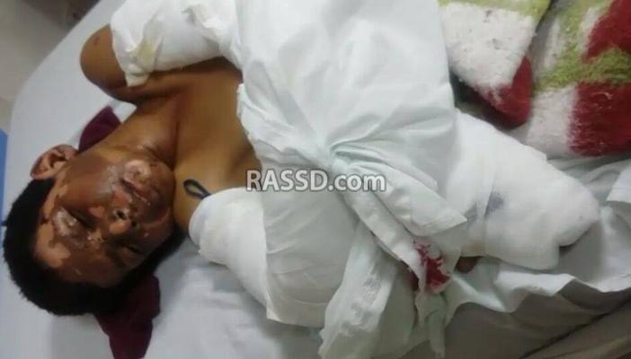 أطفال الشيخ زويد يحترقون بين ألغام ولاية سيناء وقصف طائرات الجيش