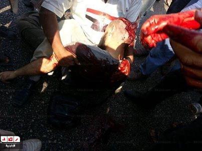 صور..50إصابة ميؤوس منها و200بالخرطوش بالتظاهرة المؤيدة بدار الحرس