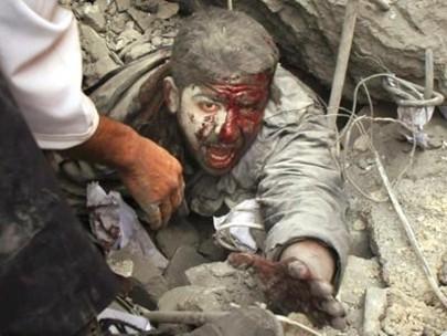 حقوقيون وأطباء:الاحتلال استخدم أسلحة فتاكة ومحرمة دوليًا