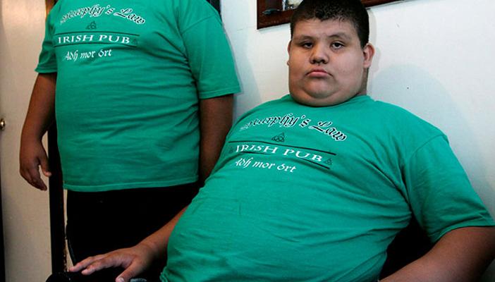 تعرف على 6 أسباب للسمنة عند الأطفال