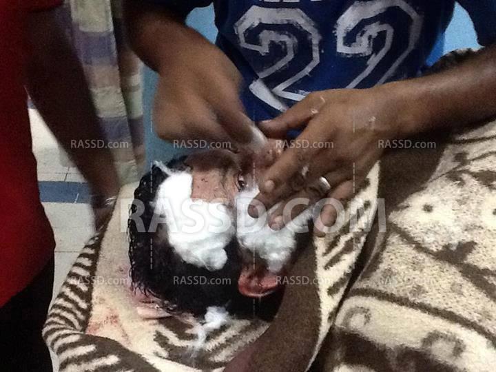 مستشفى العريش توجه نداء عاجل للقوات المسلحة