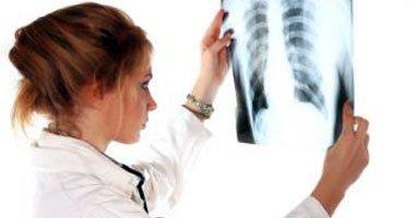 أشعة الشمس السلاح الرئيسى لعلاج لين العظام