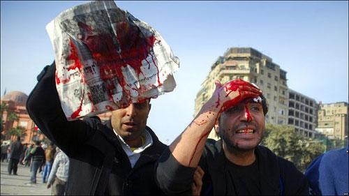 مصابي ثورة يناير يموتون بالإهمال و30 يونيو في المستشفيات الفندقية