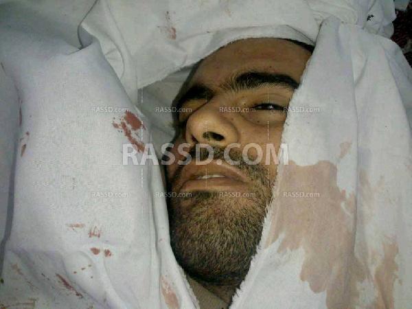 الصحة ترفض إصدار تصريح الدفن الخاص بمصور رصد