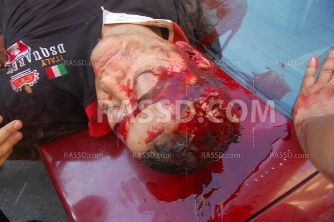 البلطجية يعتدون على مسيرة العصافرة بالاسكندرية ووقوع إصابات