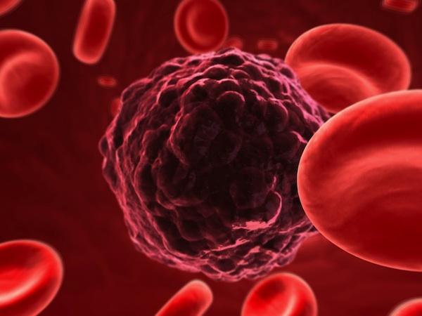 دراسة بريطانية تحذر: السمنة تزيد من فرص إصابة النساء بالسرطان