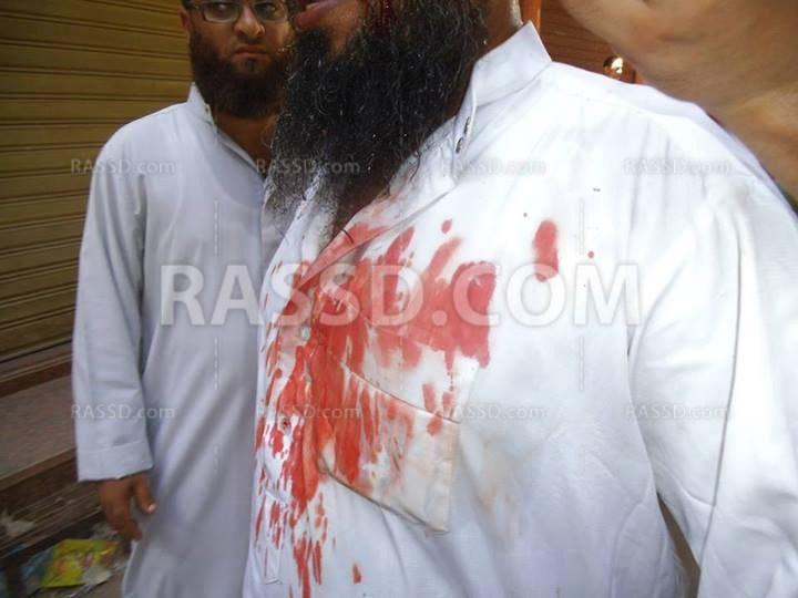 صور ..دماء على طريق الحرية بمليونية “الوفاء للشهداء”