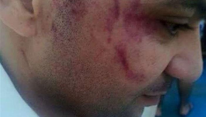 بالفيديو.. انتفاضة أردنية لنصرة المصري المعتدى عليه من قبل “الشوابكة”