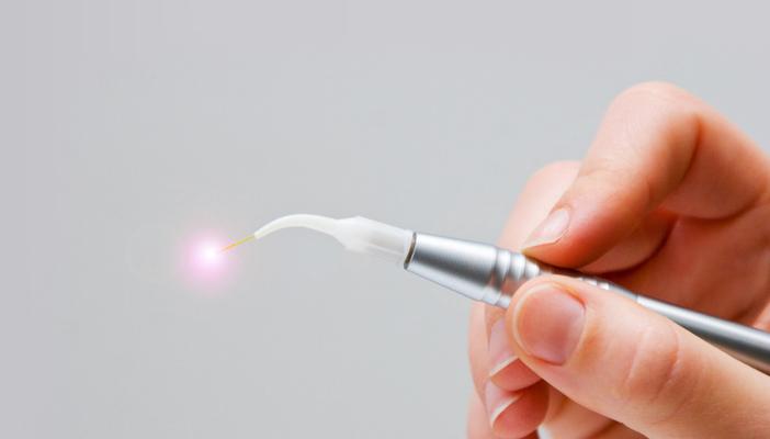 الليزر أحدث صيحة لعلاج أمراض القلب