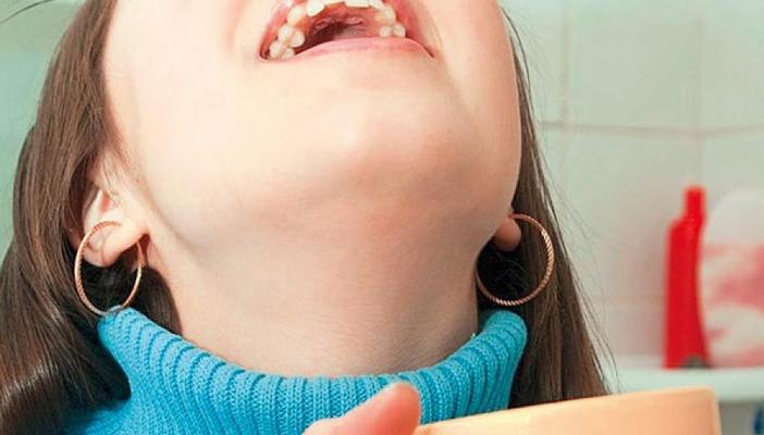 دراسة: الغرغرة بالشاي علاج لجير الأسنان ولكن قد تسبب اصفرارها