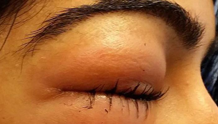 بالصور.. تمارين كتم الأنفاس تهدد بريطانية بالعمى