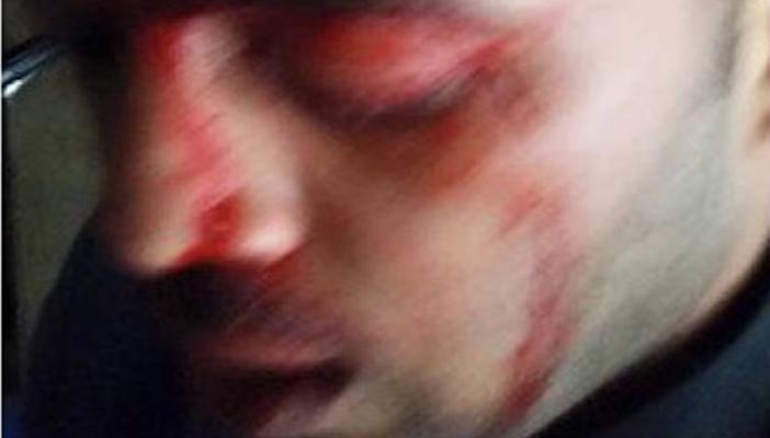 بالفيديو.. المحامي المعتدى عليه: الداخلية تتعمد إرهاب المواطنين