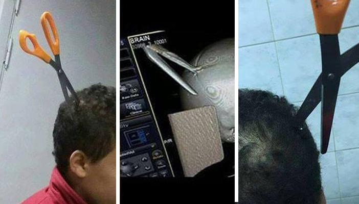 بالصور.. سيدة في المنصورة تعاقب ابنها بغرز مقص في رأسه