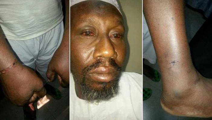 بالفيديو.. آثار التعذيب على جسد المواطن السوداني ضحية الشرطة المصرية