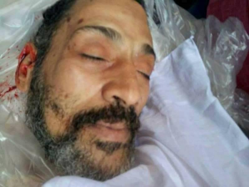 مصادر بالطب الشرعي: لاتوجد آثار تعذيب في أماكن حساسة على جثمان”مكين”