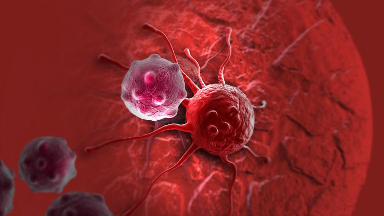 دراسة أميركية: السرطان يهدد ثلث سكان العالم