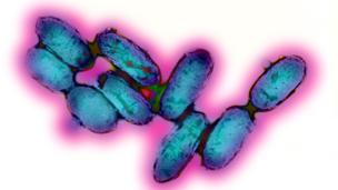 تفشي وباء الطاعون في قرية بمدغشقر