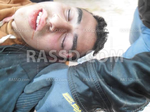 مركز طبي بمدينة نصر يرفض إسعاف متظاهر مصاب في الرأس