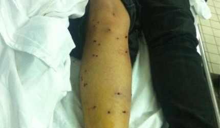 مجهولون يطلقون الخرطوش على رئيس محكمة بالدقهلية