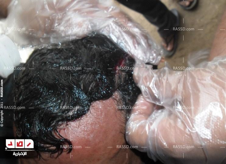 وقوع أول حالتين إصابة في اشتباكات بين المتظاهرين والأمن “بالقصر العيني”