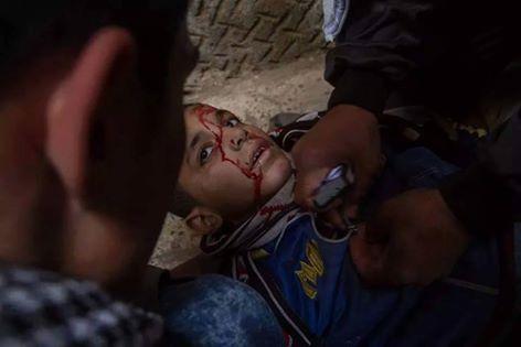 الصحة: مقتل 16 ومصادر ميدانية تؤكد ارتفاعهم  لـ20 شهيدًا