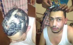 تجديد حبس المتهم بتعذيب مرضى مركز “المدمنين المجهولين” 15 يوم