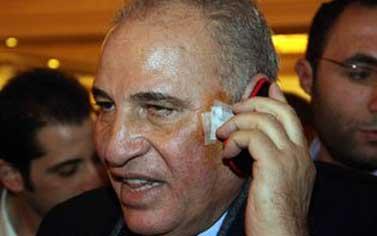 تأجيل محاكمة المتهمين فى التعدى على الزند لـ 4 مارس