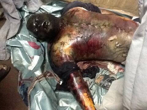 “الجارديان” تروي تفاصيل مجزرة ترحيلات “أبوزعبل” ج3