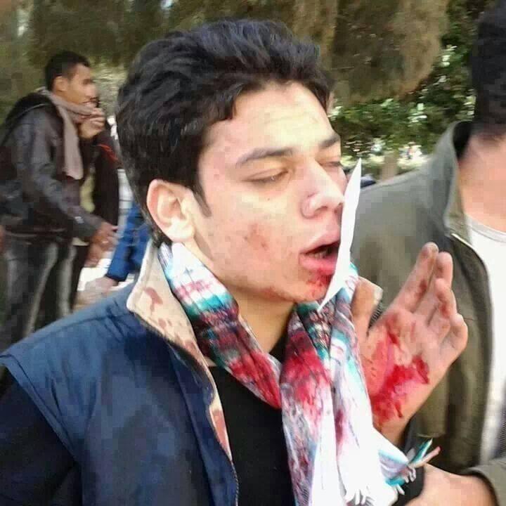 داخلية الإنقلاب تلفق تهم  لطالبين بسبب إسعاف زميلهم بمسيرة