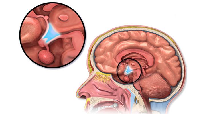 اكتشاف منطقة الشر في المخ واحتمالات التحكم بها