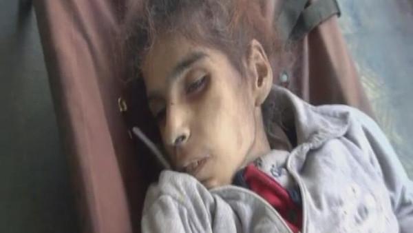 وفاة 43 شخصاً بسبب “الجوع” في سوريا