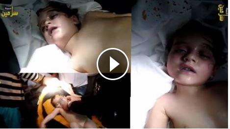 بالفيديو.. الجيش السوري يقصف أطفال “سرمين” بالكيماوي