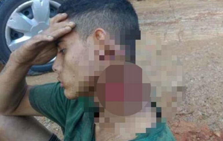 “الروح غالية”.. مراهق يحمل رأسه “المذبوح” مئات الأمتار أملاً في إسعافه