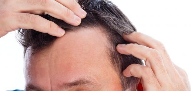 تعرف على أسباب ظهور الشعر الأبيض مبكرًا