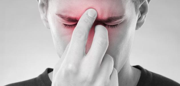 خمس وصفات طبيعية لعلاج الجيوب الأنفية