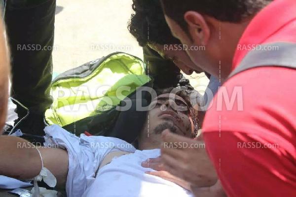 خاص رصد.. فيديو استشهاد الطالب محمد أيمن بجامعة عين شمس