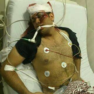 استشهاد كريم شامة متأثرا بإصابته في المطرية برصاص الانقلاب